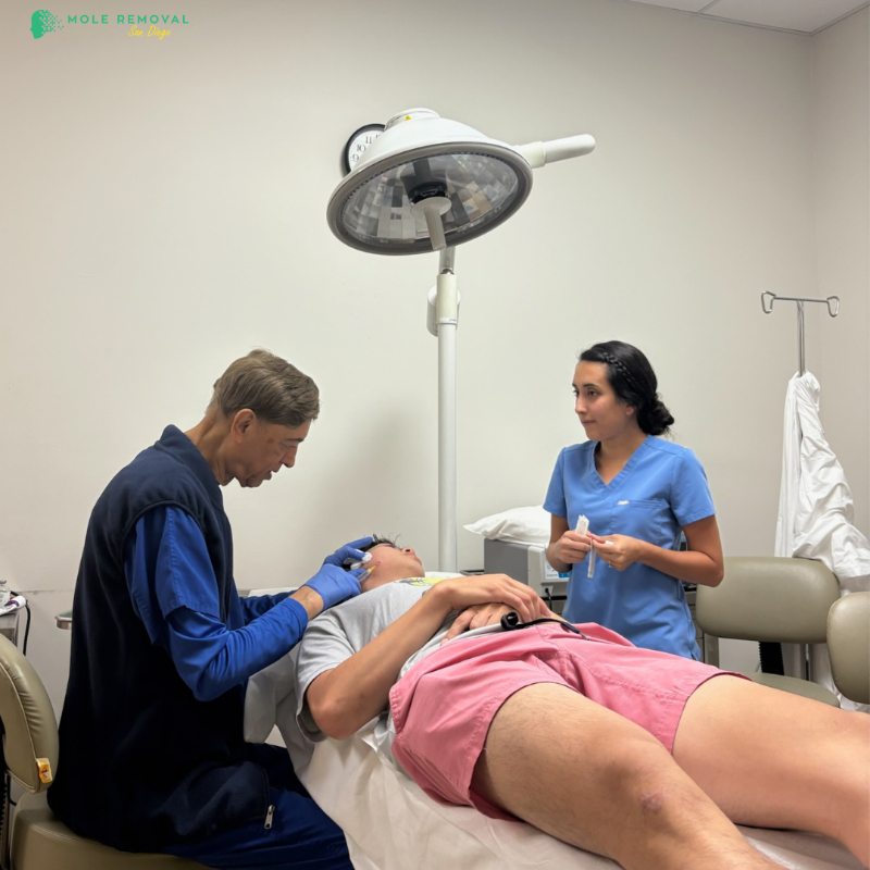 Learn More About Mole Removal San Diego 4 Get Smoother, Clearer Skin with Professional Mole Removal in San Diego 1